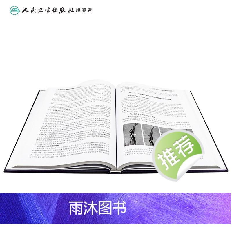 [正版]脑血管病介入治疗学(第2版)9787117159852高清大图