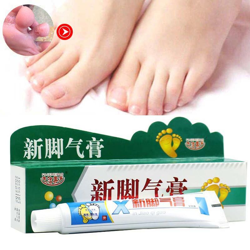 去脚气膏脚臭脚痒脚脱皮汗脚水泡开裂香港脚治脚气药脚气喷雾25g白色