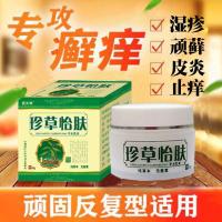 【活动价】珍怡肤皮肤止痒膏湿疹止痒药膏 湿疹膏 牛皮癣膏体股藓定制定金