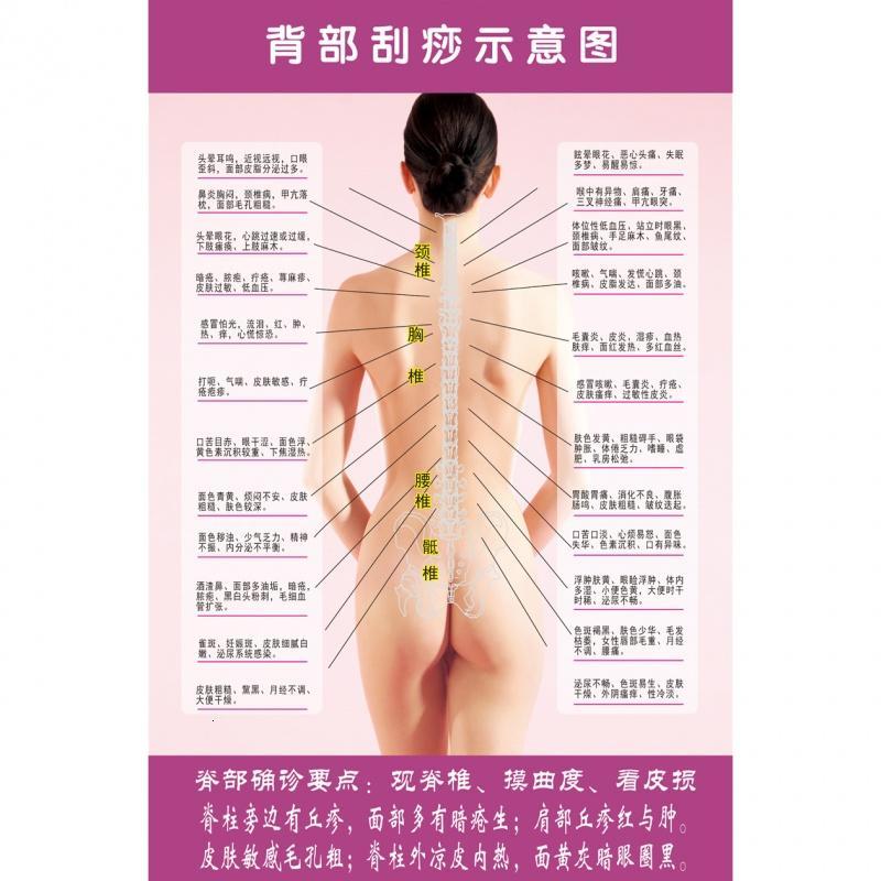 背部刮痧示意图 养生馆人体穴位挂图 中医宣传海报 脊背确诊