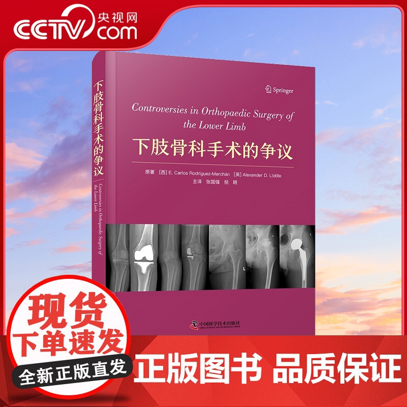 【央视网】下肢骨科手术的争议 一部专门分析近年来有关下肢关节矫形手术方面各种关键争议性问题的著作ZK