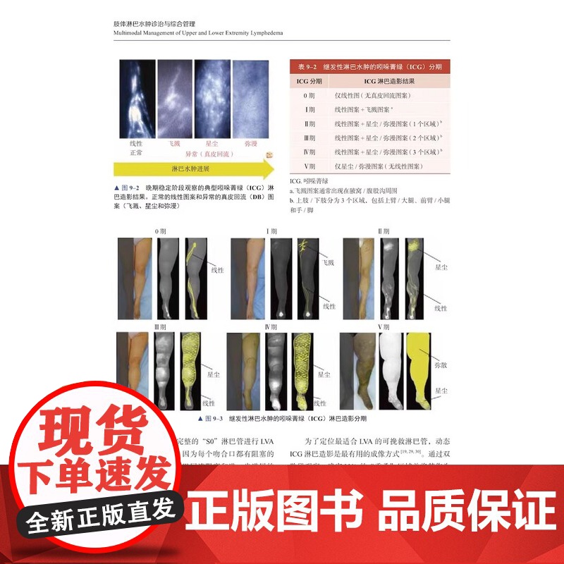 肢体淋巴水肿诊治与综合管理本书对外科肿瘤外科血管外科淋巴外科妇产科医生等开展临床工作治疗淋巴水肿有较好的指导和参考作用Z高清大图
