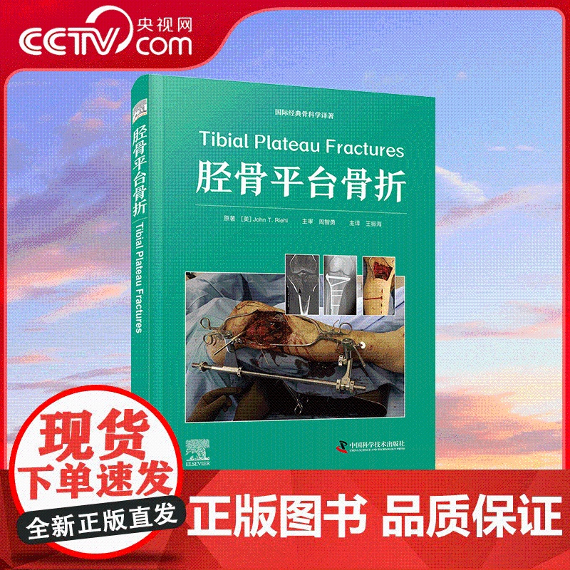 [央视网]胫骨平台骨折 Tibial Plateau Fractures 一部关于胫骨平台骨折的专业著作 ZK高清大图