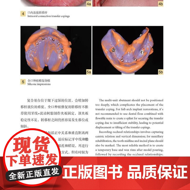 数字化种植导板与全瓷修复中的医技实践 数字化技术在口腔种植和修复领域应用 种植导板 全瓷修复材料 辽宁科学技术