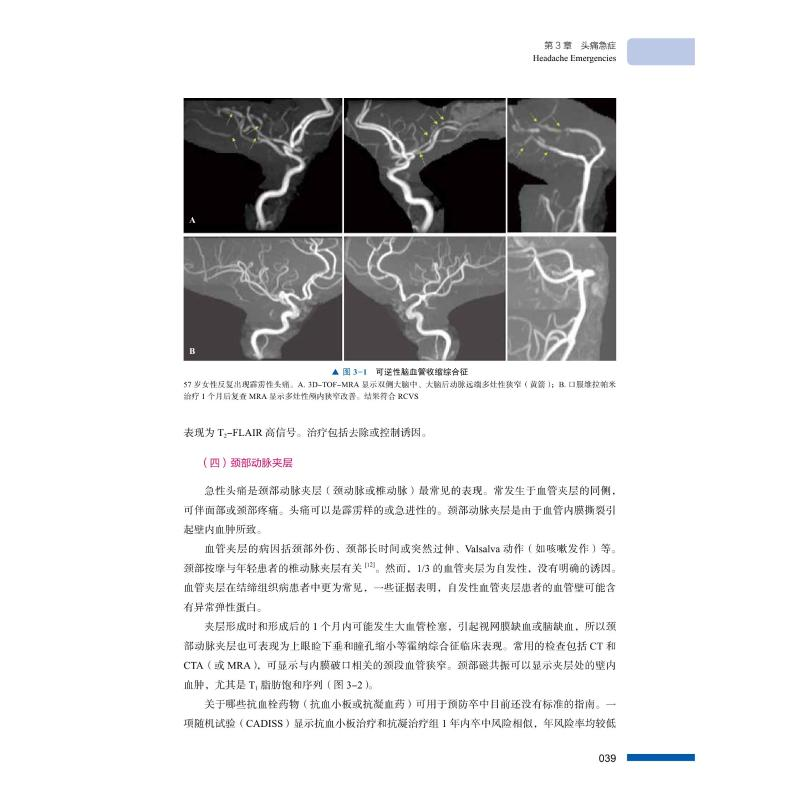 醉染图书实用神经急症诊疗精要9787504690593高清大图