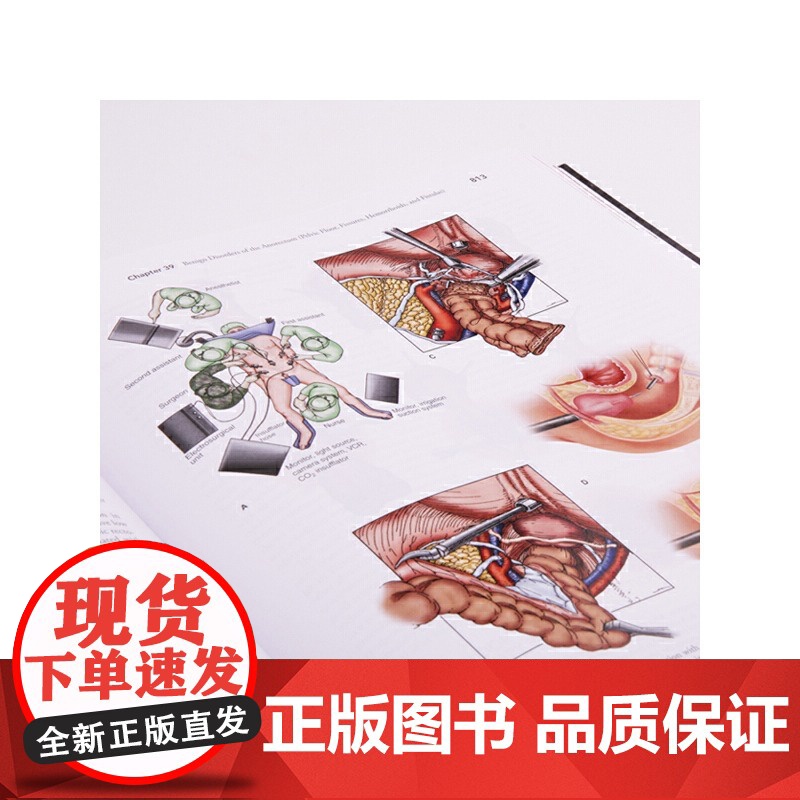 [央视网]Maingot腹部手术第12版英文版 关注手术过程 提高实操技术 关注手术过程和疾病诊疗方面的新观点HL高清大图