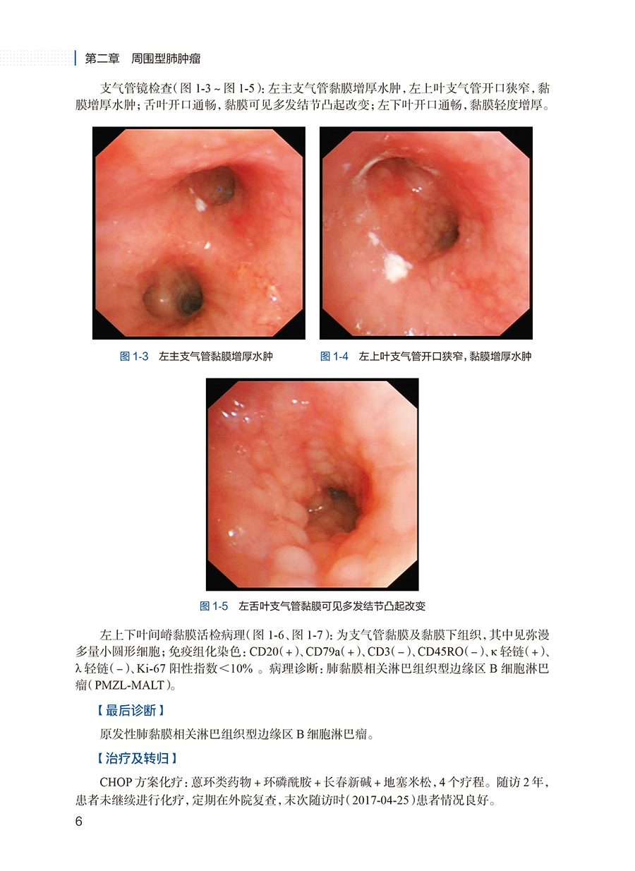 [正版]呼吸系统少见病病例解析 王洪武 徐凯峰 少见罕见病临床特征治疗过程 医学影像支气管镜检查典型表现 人民卫生出版高清大图