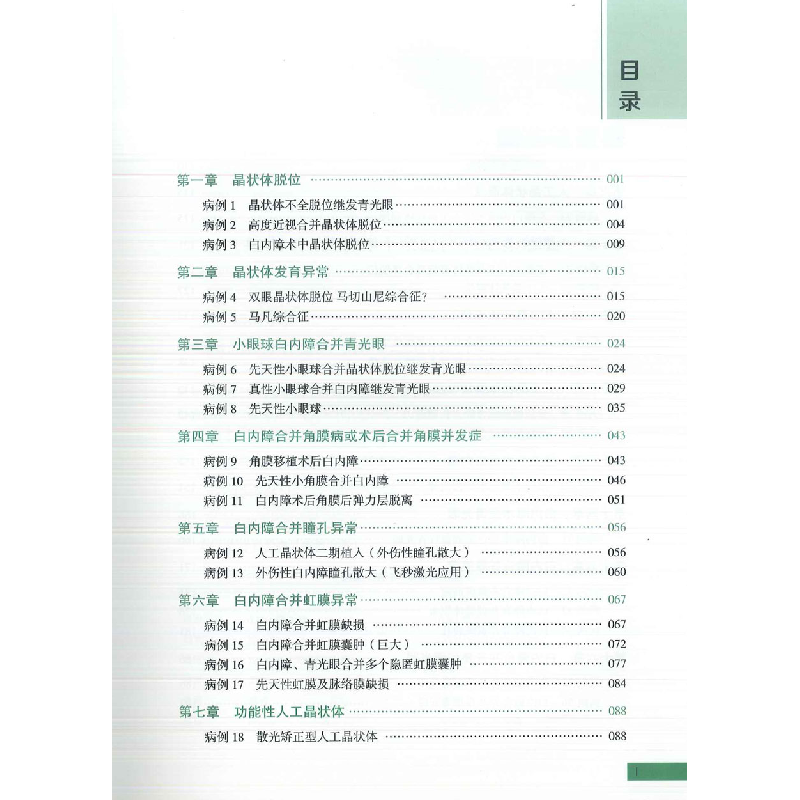 正版新书]白内障手术特殊病例思辨党光福 主编9787543987234高清大图
