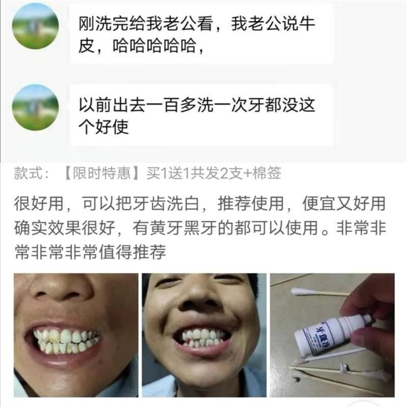 [去黄牙黑牙]牙斑净去黄牙黑牙垢牙结石烟渍茶渍牙齿美白脱色剂 1支装