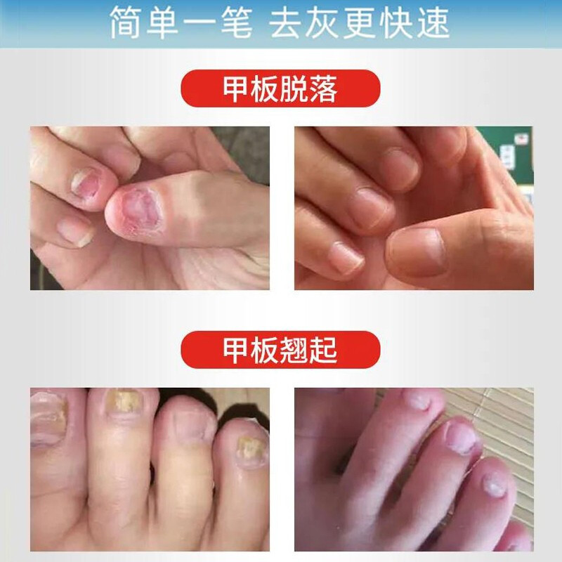 欧佩(ou pei)美手工具报价_参数_图片_视频_怎么样_问答-苏宁易购