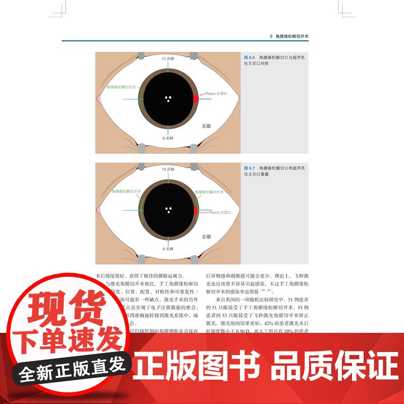 屈光性白内障手术技术与艺术 上海科技出版社眼科医师白内障晶状体疾病专科指导教材高清大图