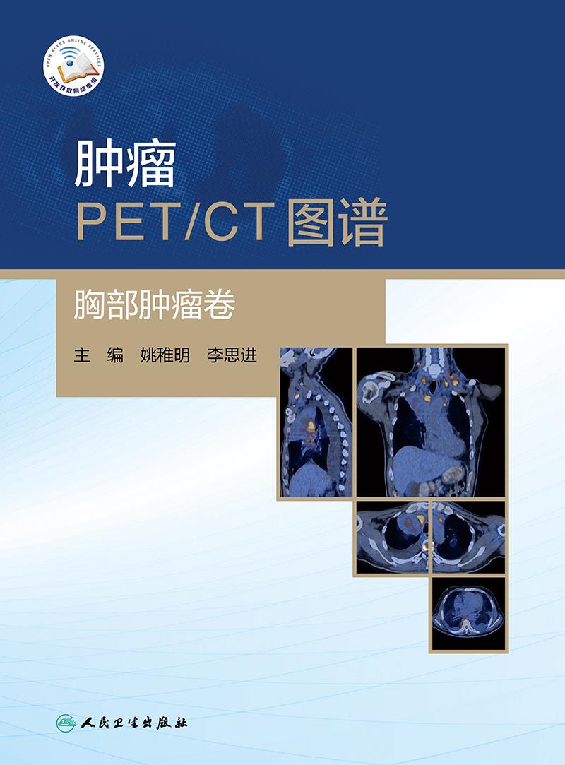[醉染正版]肿瘤PET CT图谱 胸部肿瘤卷 T影像医学书籍以典型病例的影像分析为主线姚稚明李思进主编978711730高清大图