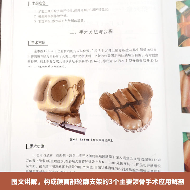 [醉染正版]正版 颌面骨骼手术图谱 面部整容 面部美学设计 医学美容书籍 医疗美容外科图谱 手术图谱 整高清大图