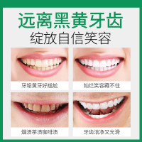 舒友阁(SHU YOU GE)洗牙粉白牙素洁牙粉白牙粉去烟渍牙粉去除牙结石牙垢黄牙牙亮白 50g/盒