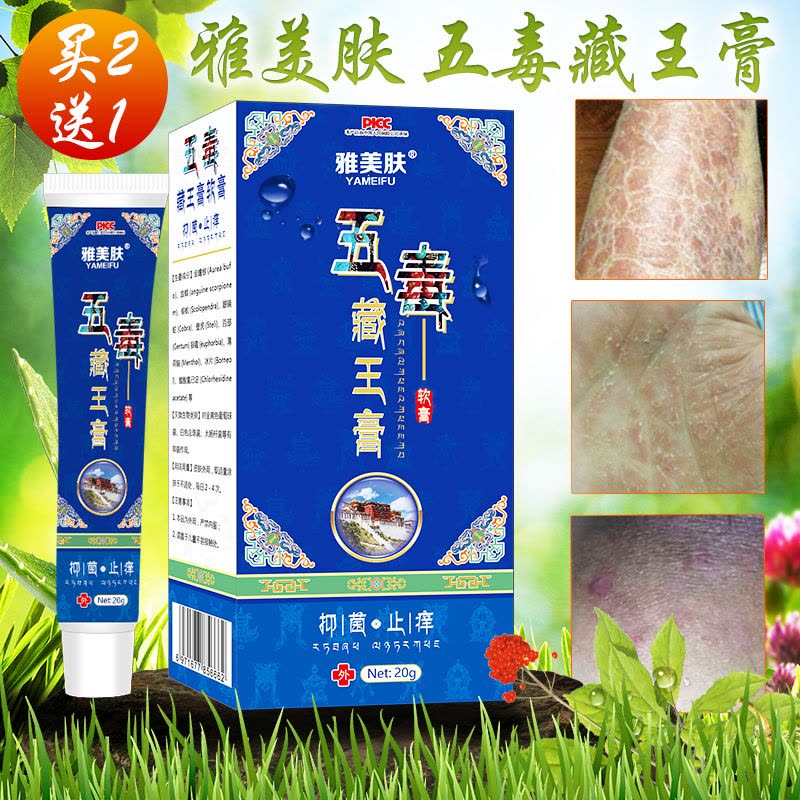 雅美肤西域湿毒清苗药五毒藏王膏治牛皮癣痒灵毛囊炎龟头炎软膏男女私处外阴部消炎皮肤外用药止痒膏汗斑癣药膏荨麻疹老中医手癣药图片