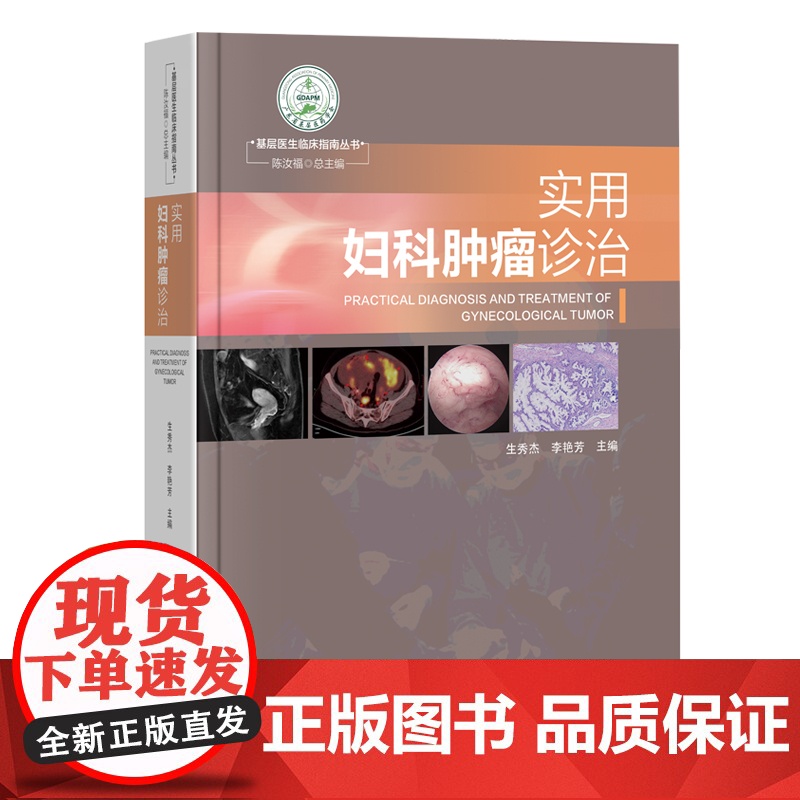 实用妇科肿瘤诊治 常见妇科良恶性肿瘤 妇科肿瘤诊治规范 妇科肿瘤的化疗放疗免疫治疗靶向治疗以及术前术后管理 出版社正品高清大图