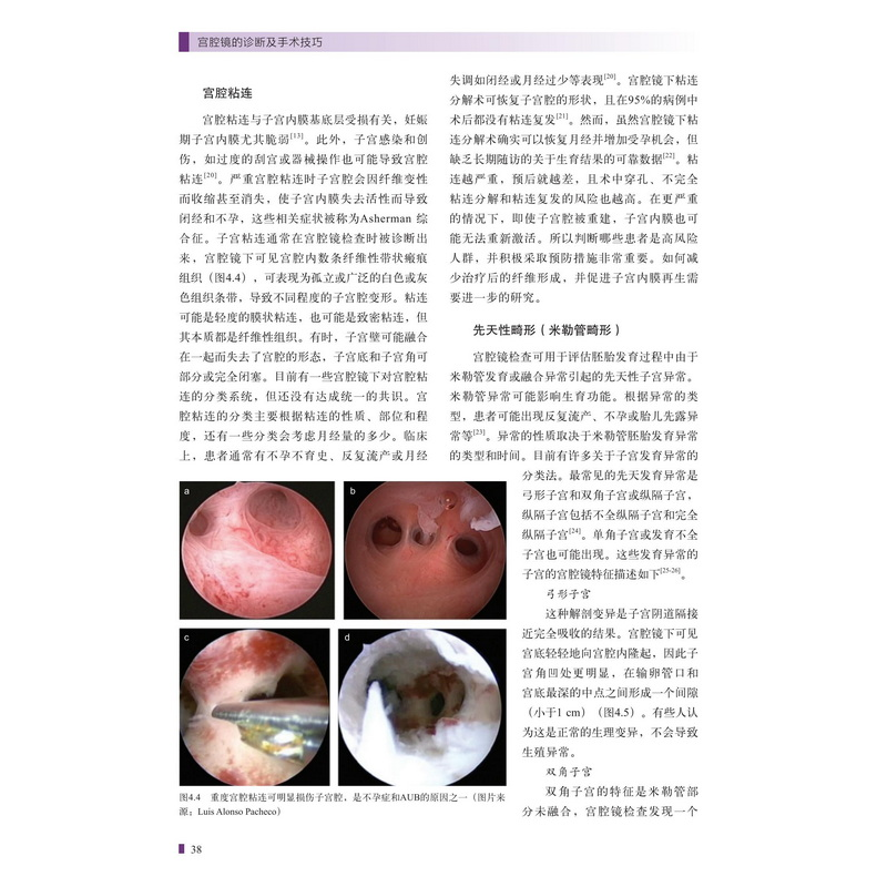醉染图书宫腔镜的诊断及手术技巧9787571421670高清大图