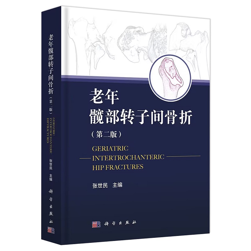 单本全册 [正版]老年髋部转子间骨折 第二版 第2版 张世民 人工髋关节置换手术实用外科学手术学骨折关节重建技术书籍临床高清大图