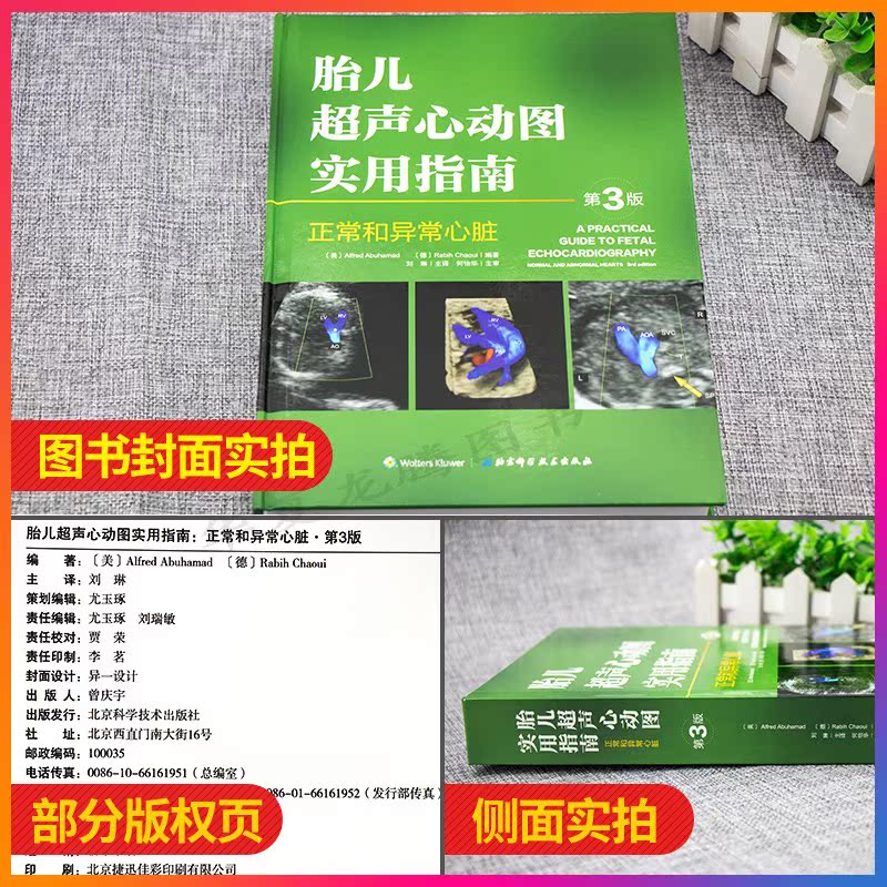 [正版]胎儿超声心动图实用指南 正常和异常心脏 第三版 妇产科学医学类书籍 胎儿心脏畸形诊断临床检查 刘琳主译 北京科学高清大图