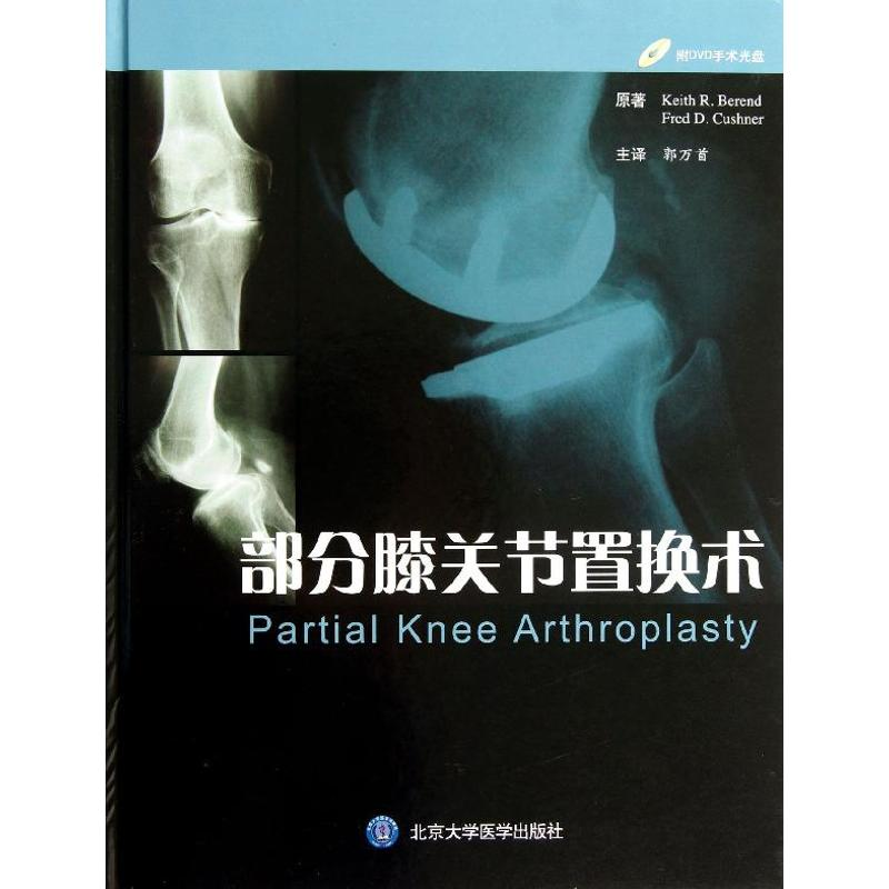 【M】部分膝关节置换术-9787565905995