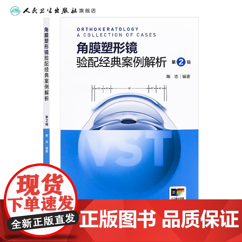 角膜塑形镜验配经典案例解析第2辑陈志配镜原则vst镜片crt近视控制技术矫正OK激光标记白内障参数识别地形图选择采集点染高清大图