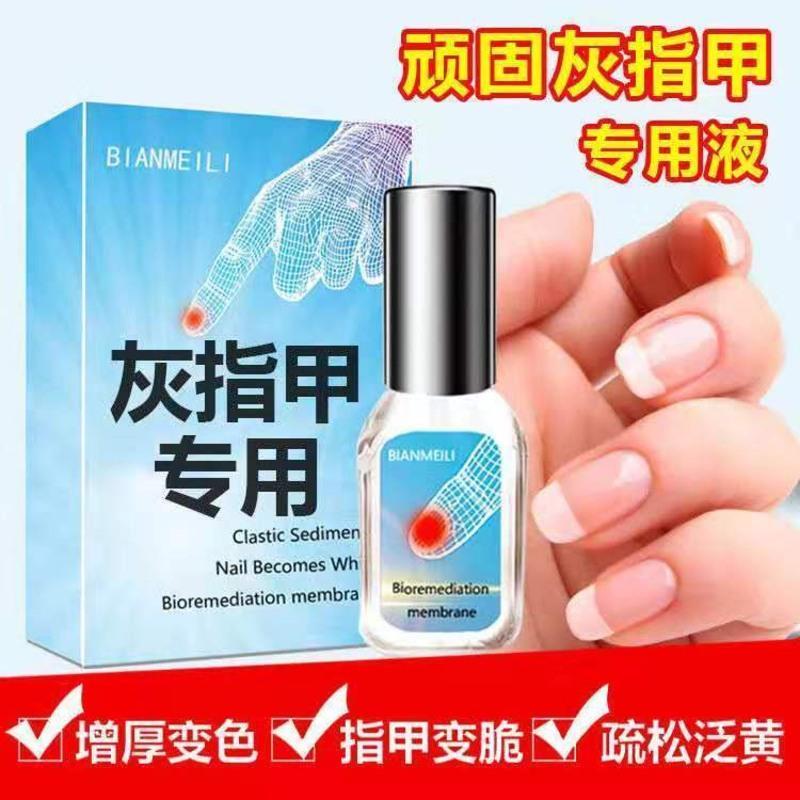 [医师推荐]治疗灰指甲特效去除增厚亮甲灰指甲专用液抑菌液 1瓶[5ml体验无]