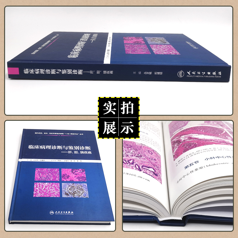 [正版] 临床病理诊断与鉴别诊断肝、胆、胰疾病 丛文铭 郑建明 病理学案例解读教程 肝胆胰疾病参考书 人民卫生出版社9高清大图