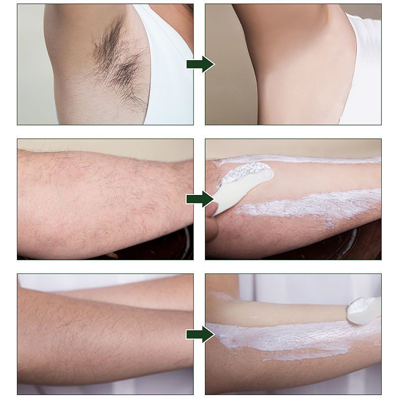 膏学生党女去全身私密处手腿毛腋下根男半永久脱毛仪神器脱毛刮板1个