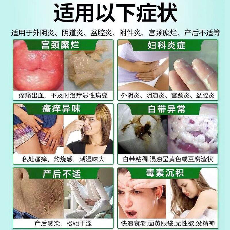苦参妇科凝胶滴虫宫颈烂糜豆腐渣炎阴道排毒白带异味瘙痒私处护理 凝胶1盒(6支装)[赠私密自检卡]