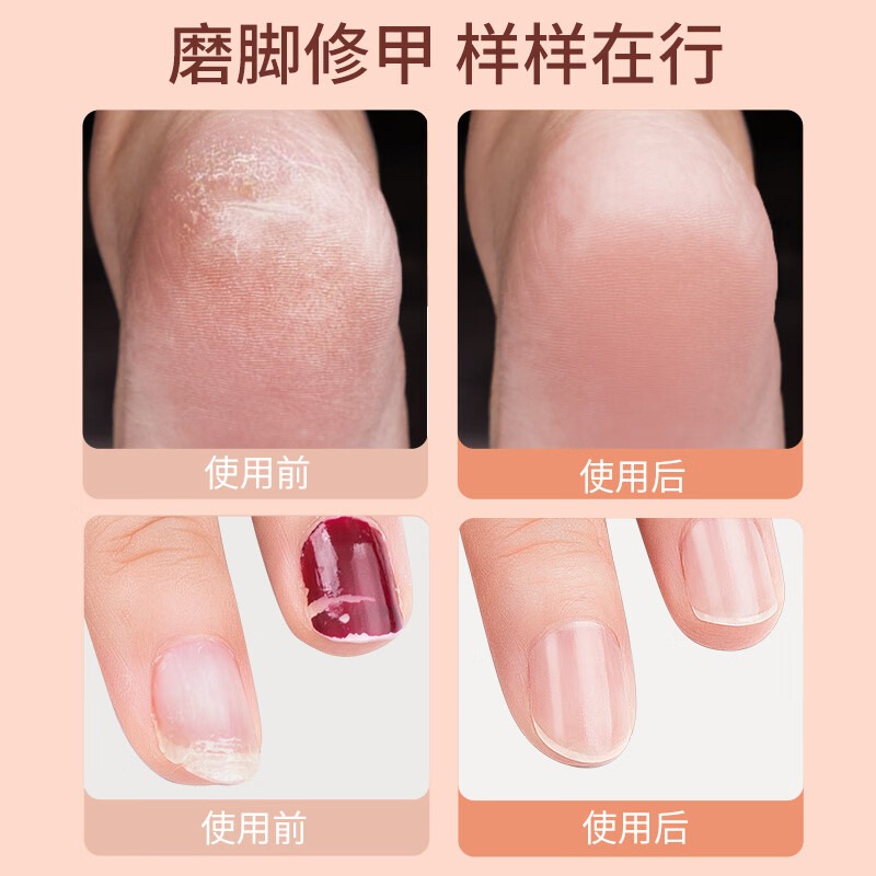 美克斯 电动修脚器 NV8615E高清大图
