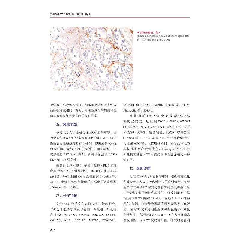 醉染图书乳腺病理学9787504689986高清大图