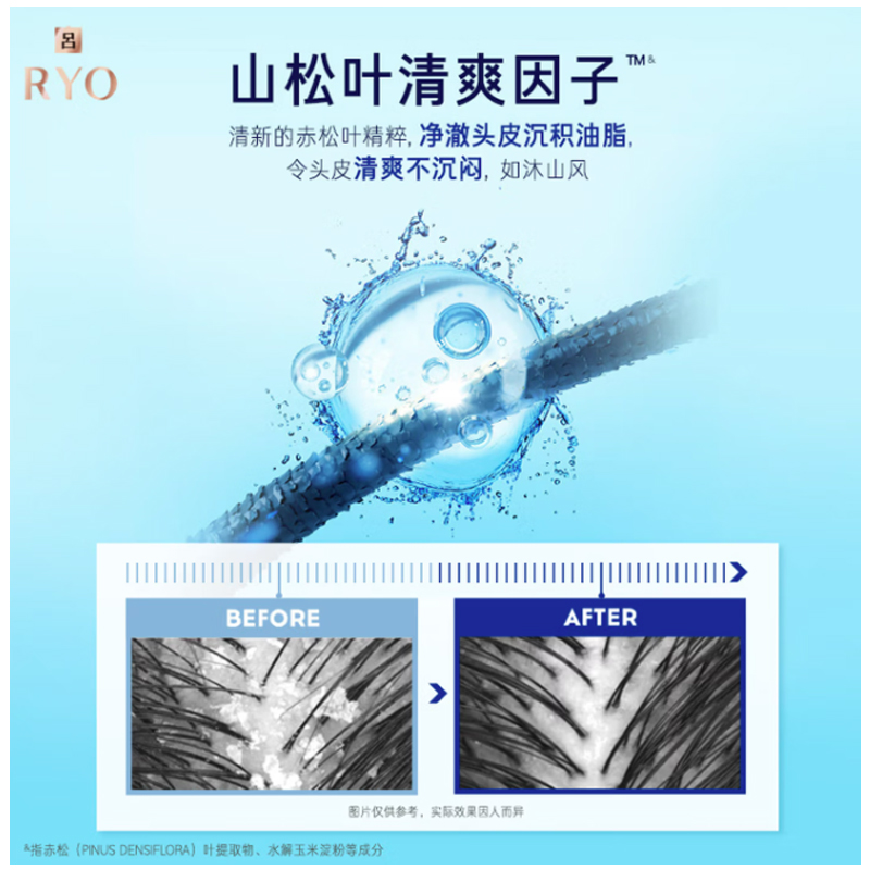 RY0蓝吕去屑洗发水400ml高清大图