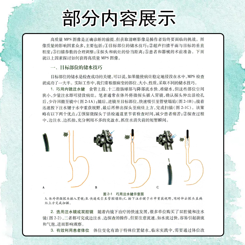 [正版] 微探头超声内镜的临床应用胡端敏诸琦主编真实临床病例超声基本原理内窥镜检超声波诊断内科学 人民卫生出版社978高清大图