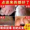 中泡手去真菌脚丫子痒烂脚起泡脱皮痒治擦脚上长水泡痒出泡起皮痒的一抹净型