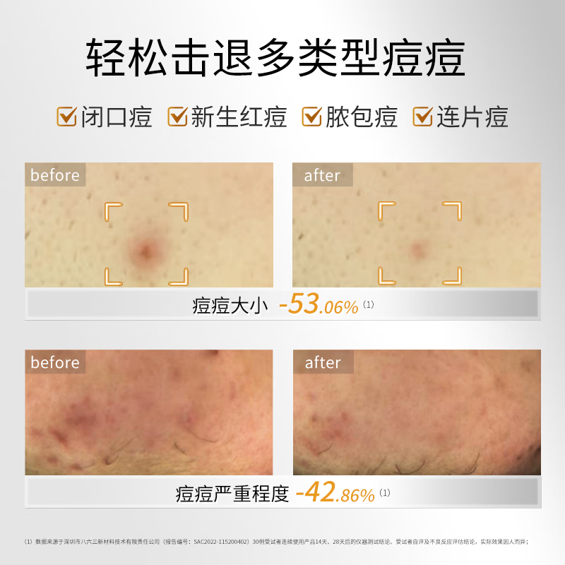 敷尔佳乳糖酸控油敛肤面膜 5贴/盒高清大图