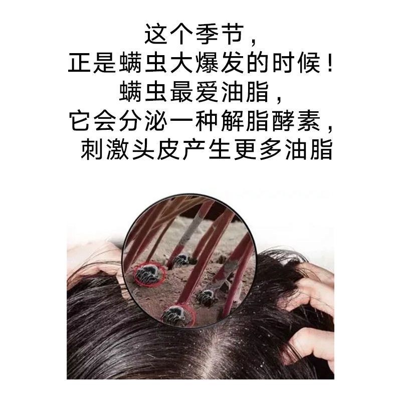 姬莱雅三椒除螨洗发皂深层清洁滋养头皮净螨护发皂控油去屑洗头皂 一盒试用体验装
