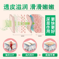 （拍2发3瓶）壹宝马油膏护理霜防冻干裂皲裂龟裂开裂36g脚臭脱皮止痒脚去裂霜烂脚丫护足霜脚气膏