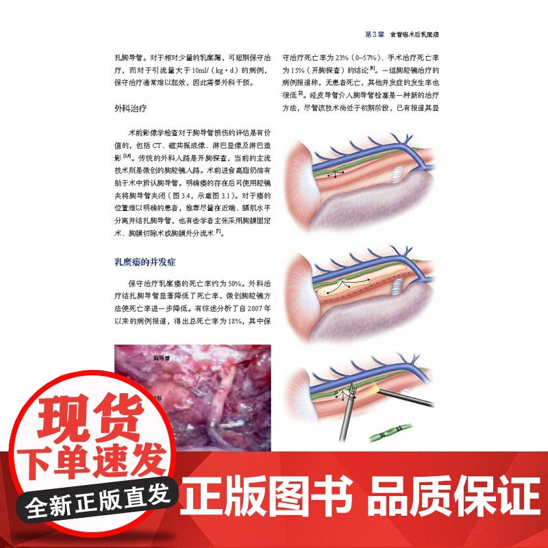 消化道术后并发症实例分析 本书为每种并发症都配有2到3个病例 所有病例均来自作者的临床手术实践 是第一手的珍贵资料高清大图