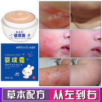 紫草膏宝宝湿疹膏戒馆之婴亲霜 婴儿口水疹尿布疹热痱子湿疹皮炎红屁屁护臀膏 奶廯润肤面霜淹红脖子肤乐霜皮肤止痒膏消肿膏面霜
