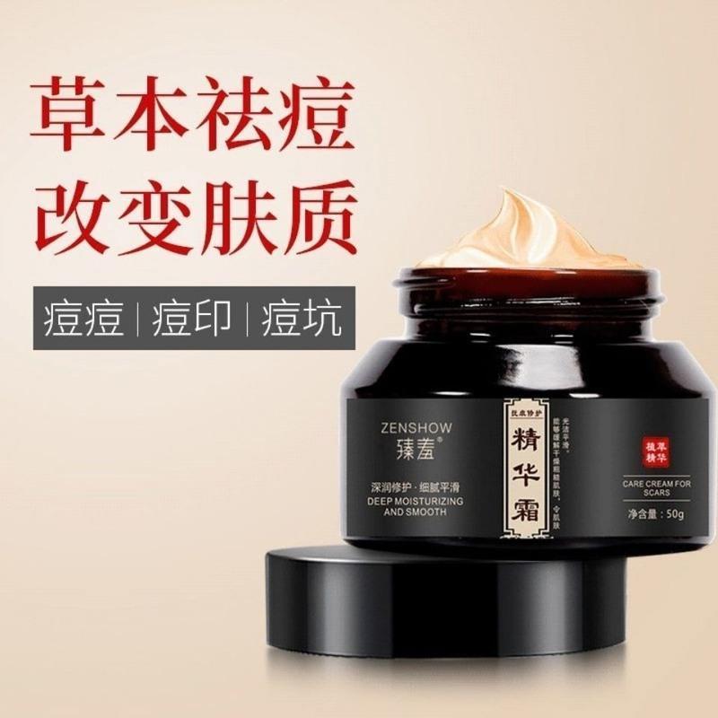 去妊娠纹产后修复霜去除肥胖纹生长纹紧致肚皮孕妇预防消除妊娠纹 修复霜(1瓶)