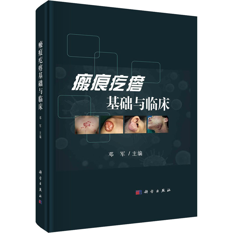 醉染图书瘢痕疙瘩基础与临床9787030728210高清大图