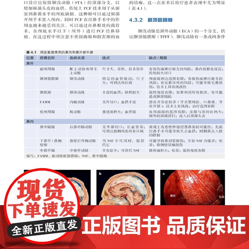 颅底外科手术的血管挑战 初中级神经外科医师内镜颅底外科领域重要参考书解剖肿瘤搭桥动脉瘤静脉神经电生理监测 辽宁科学技术出高清大图