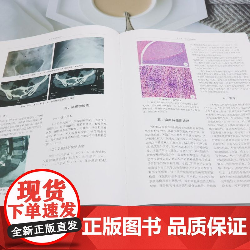 实用脊柱肿瘤学