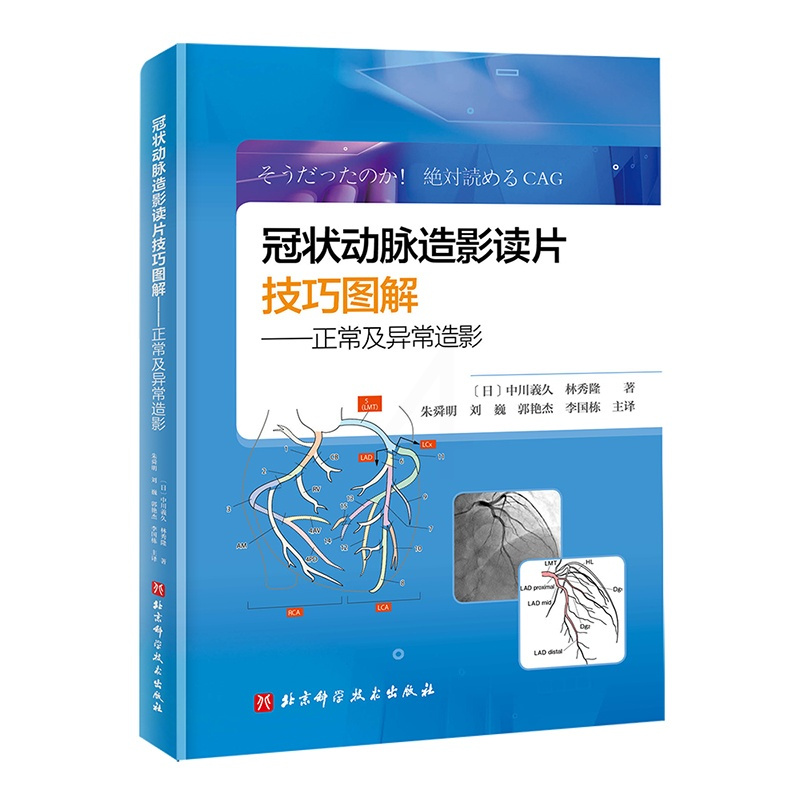 [正版]书冠状动脉造影读片技巧图解 正常及异常造影 教你从冠脉造影小白 快速进阶PCI达人 北京科学技术出版社书籍
