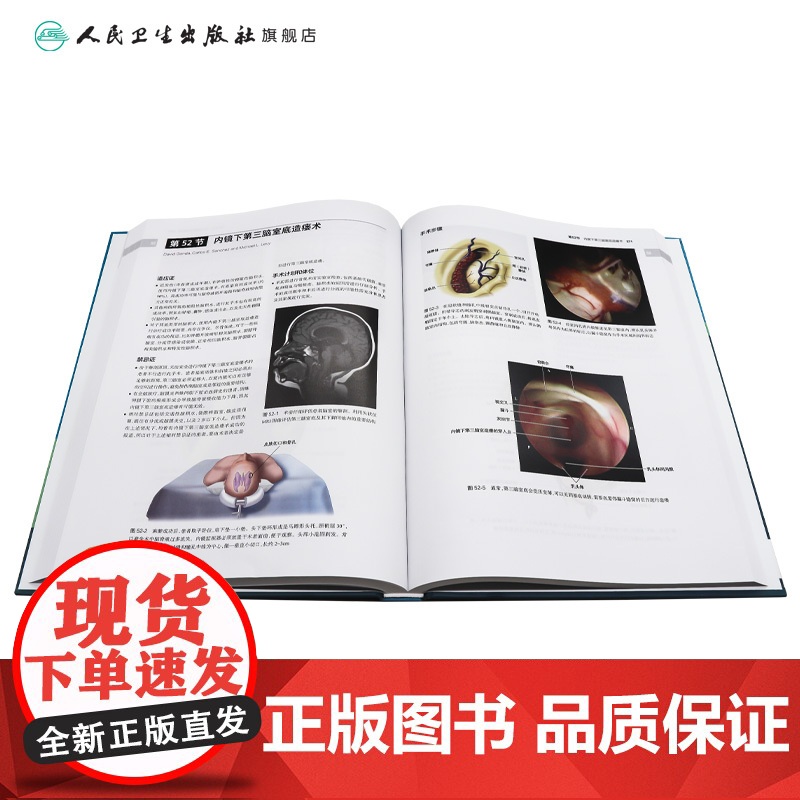 神经外科手术核心技术 第2版 血管病手术 经翼点入路前交通动脉瘤开颅夹闭术 主编 卜博 章文斌 人民卫生出版社 9787高清大图