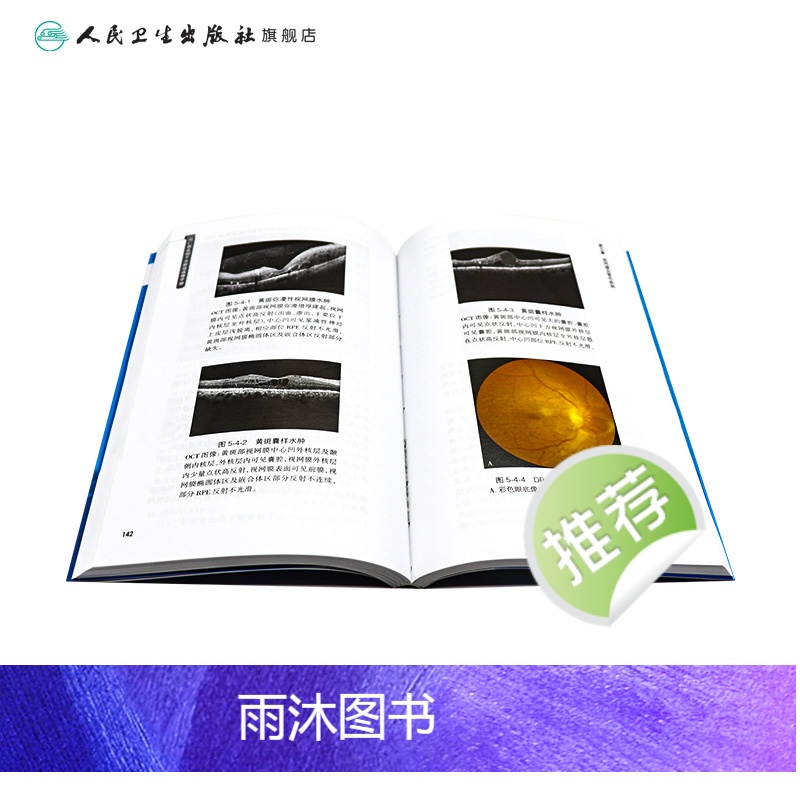 [正版]同仁眼底相干光断层成像手册(同仁眼科手册系列) 2023年10月参考书 9787117350181高清大图