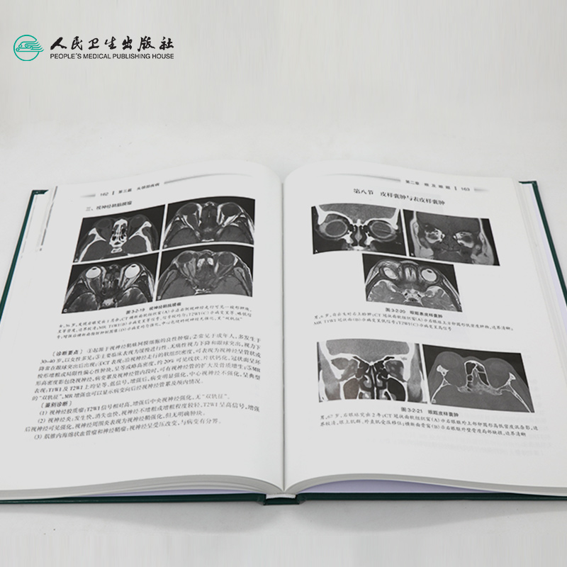 [正版]医学影像学读片诊断图谱头颈分册 头颈胸腹骨肌部放射医学超声诊断学影像解剖学胸部影像学x线读片指南磁共振ct诊断高清大图