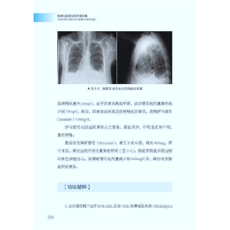 正版新书]肿瘤心脏病学临床病例集[加]Atooshe Rohani9787504694高清大图