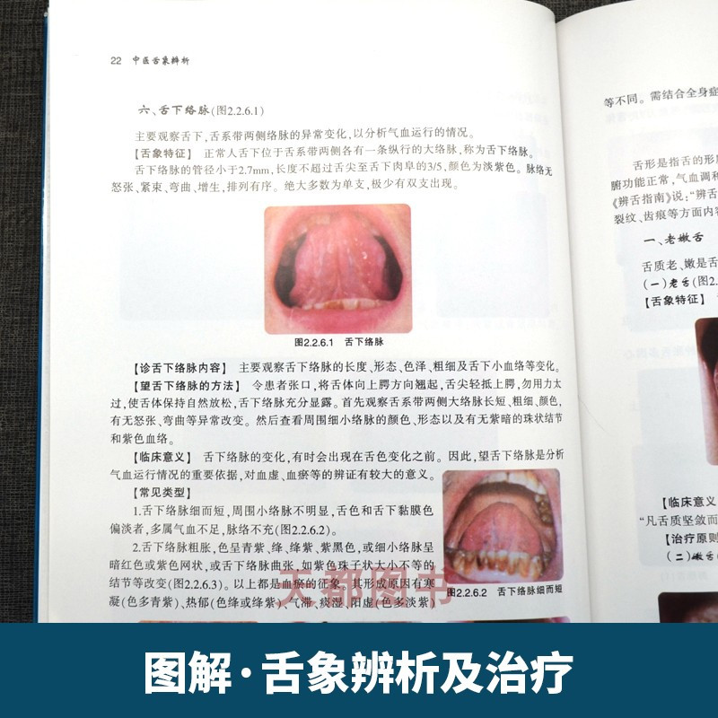 [正版]中医舌象辨析 舌诊书图解舌诊断病伸伸舌头把病解入门图谱教程中医养生书籍舌像舌苔辨析临床病症望舌诊病 天津科技翻译