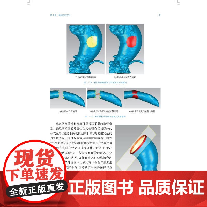 心脑血管植介入器械建模仿真与应用 上海科技出版社计算机建模仿真研究成果高端国产医疗器械发展高清大图